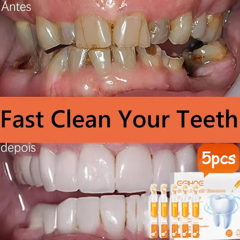 Teeth Whitening With Baking Soda - Snel Reparatie Tandvlees Serum Verlichten Terughoudend