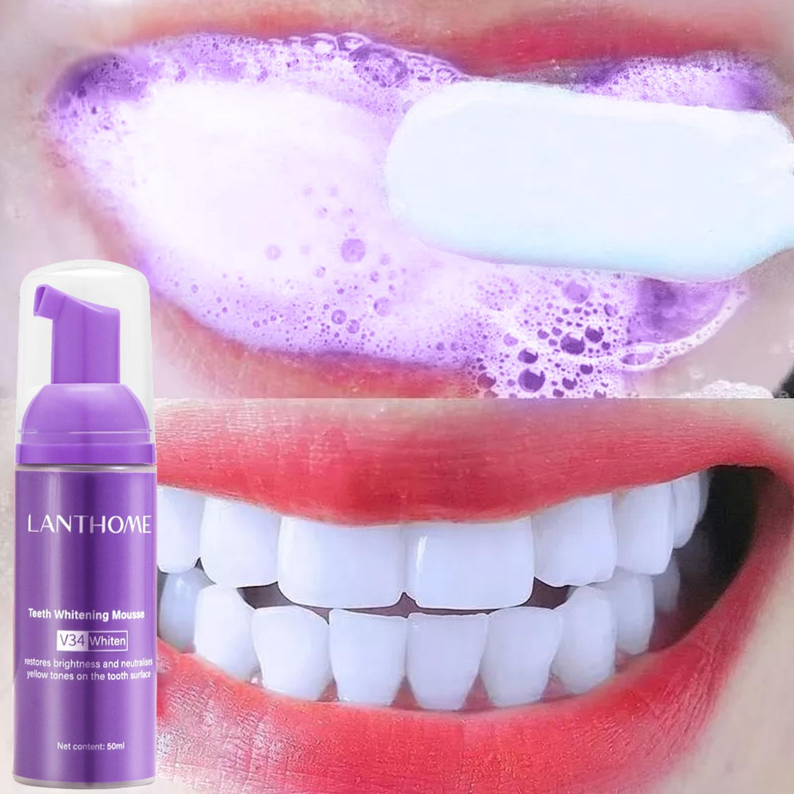 Teeth Whitening At Home - V34 Mousse Tanden Reinigen Tandpasta Effectieve