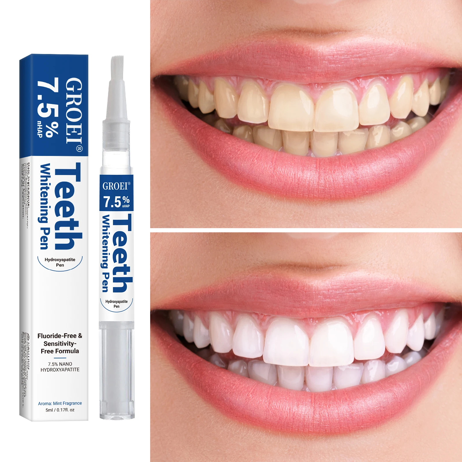 Hydroxyapatite Tand Whitening  - Teeth Whitening Results recensie en prijs