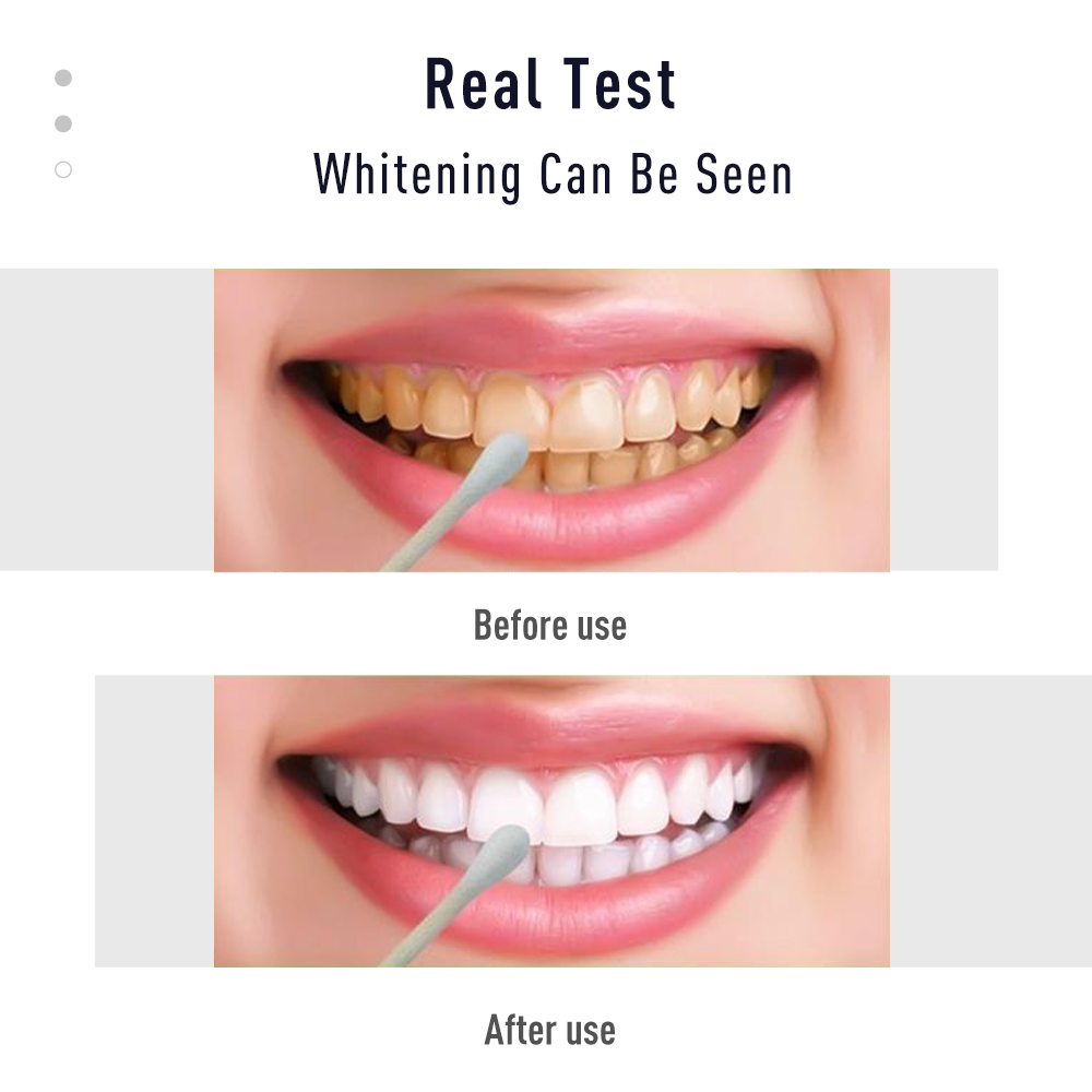 Pen Tand Gel White Kit Reinigi - Whitening Pen Bleach recensie en prijs