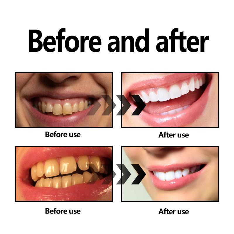 Tandenbleekpoeder Houtskool /  - Teeth Whitening With Baking Soda recensie en prijs