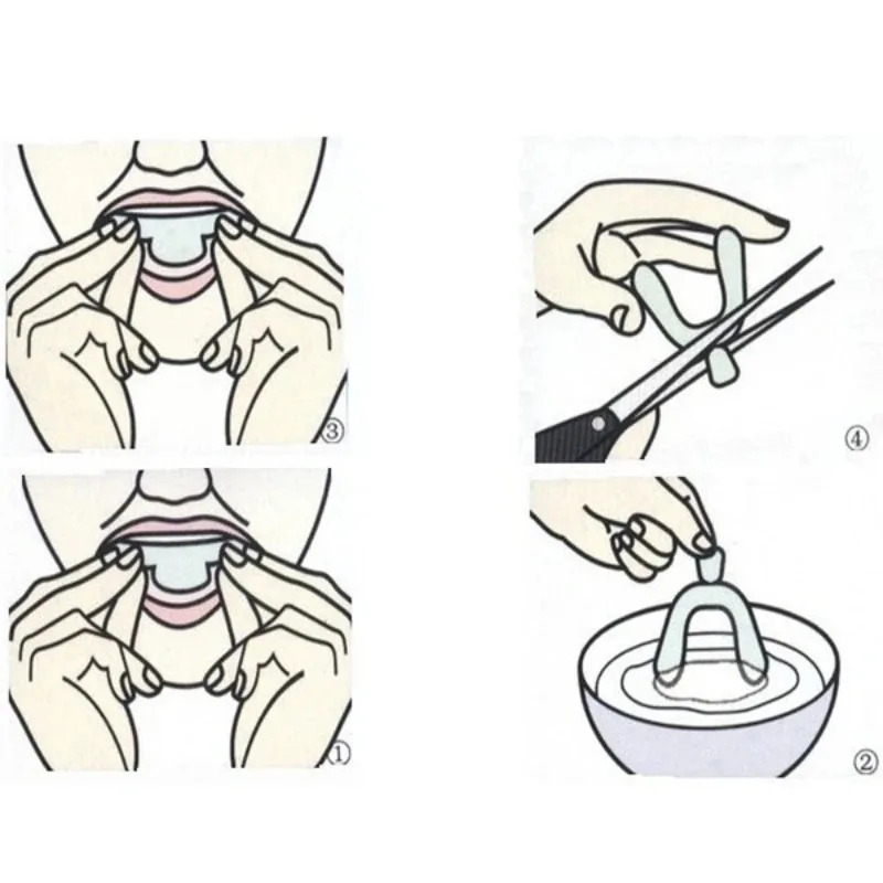 1/3/6pairs Siliconen Mondbesch - Teeth Whitening With Trays recensie en prijs