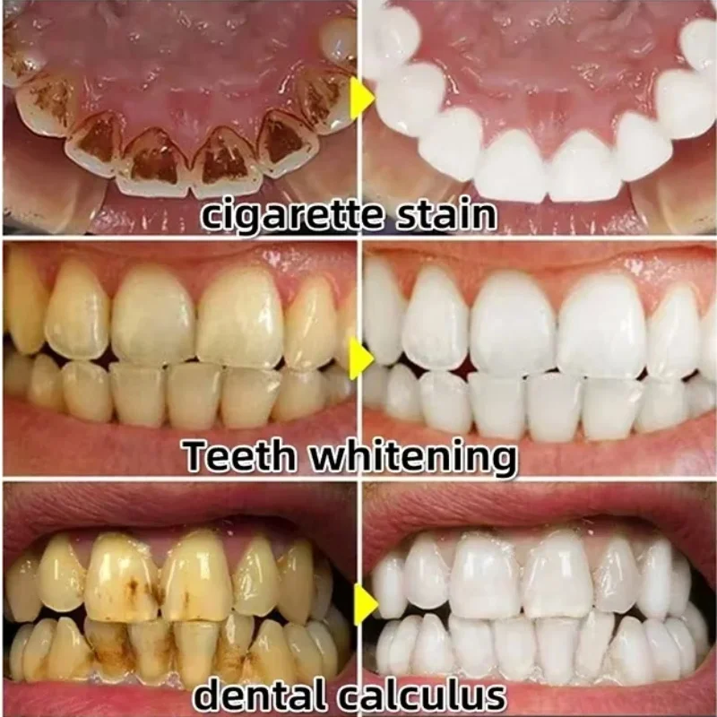 Snel Reparatie Tandvlees Serum - Teeth Whitening With Baking Soda recensie en prijs