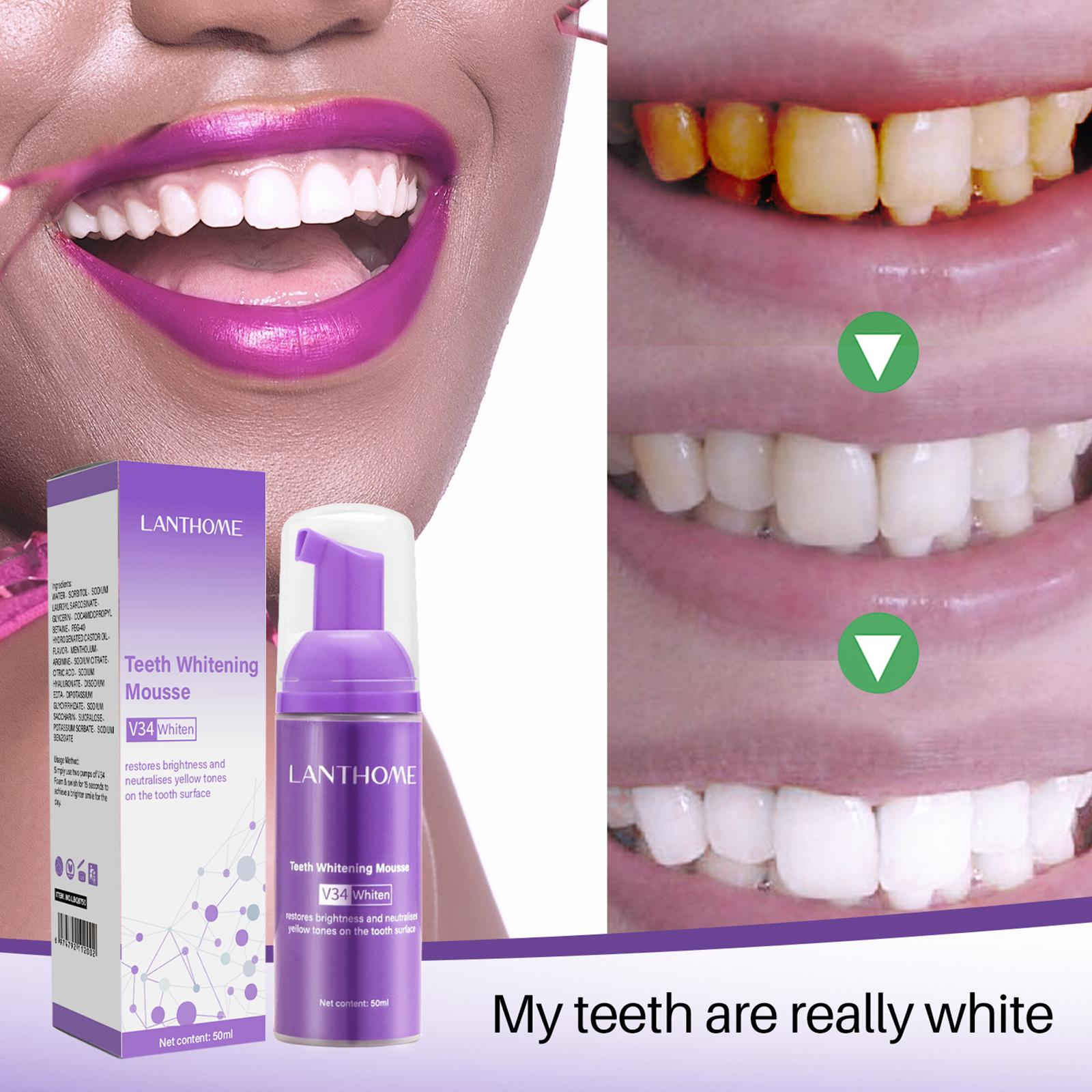 V34 Mousse Tanden Reinigen Tan - Teeth Whitening At Home recensie en prijs