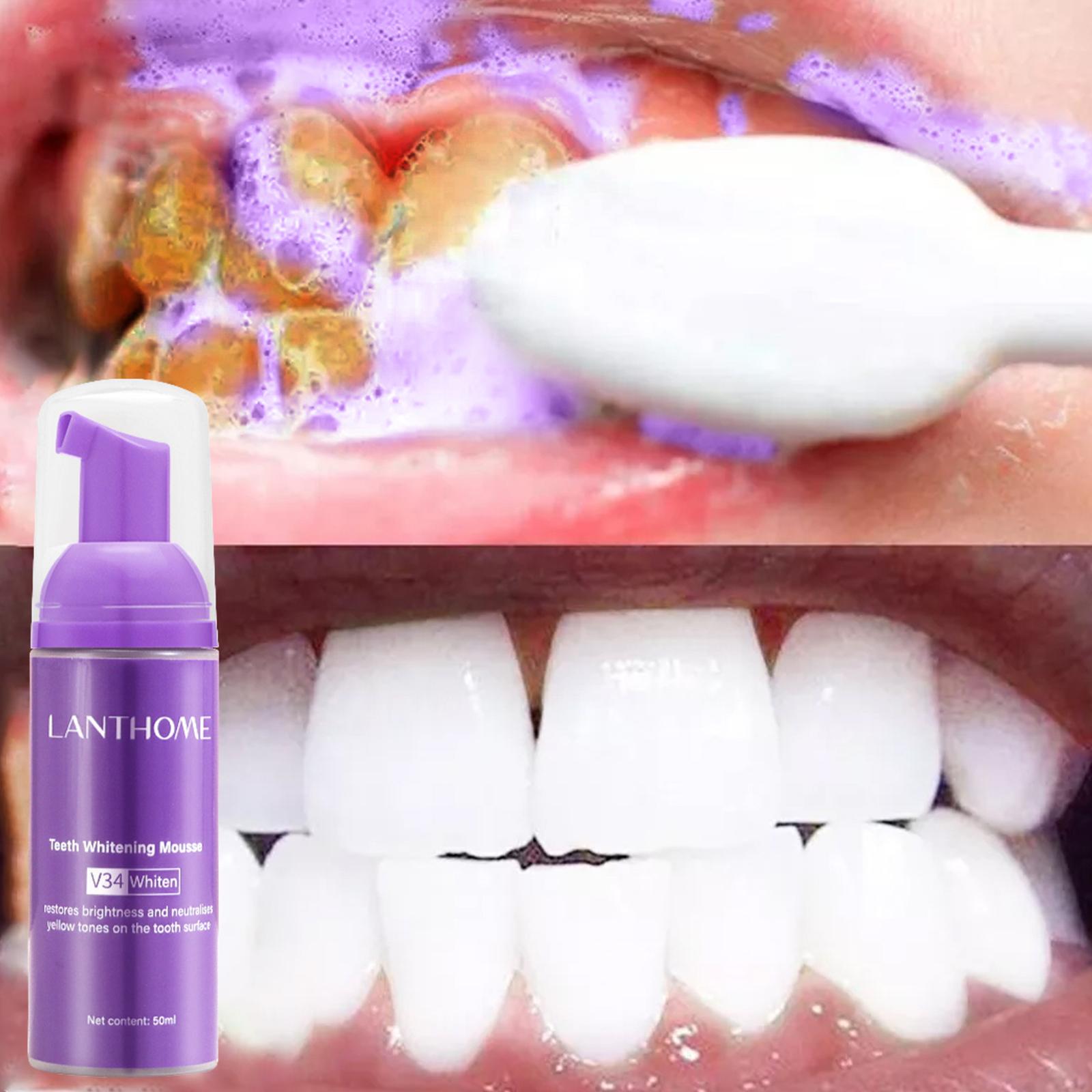 V34 Mousse Tanden Reinigen Tan - Teeth Whitening At Home recensie en prijs