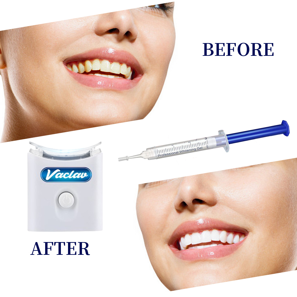 Mint Tanden Whitening Gel Spui - Teeth Whitening With Baking Soda recensie en prijs