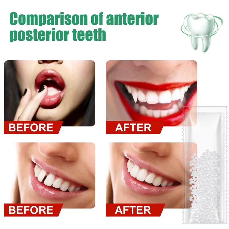 10g50g/30ml Hars Tand Reparati - Teeth Whitening At Home recensie en prijs