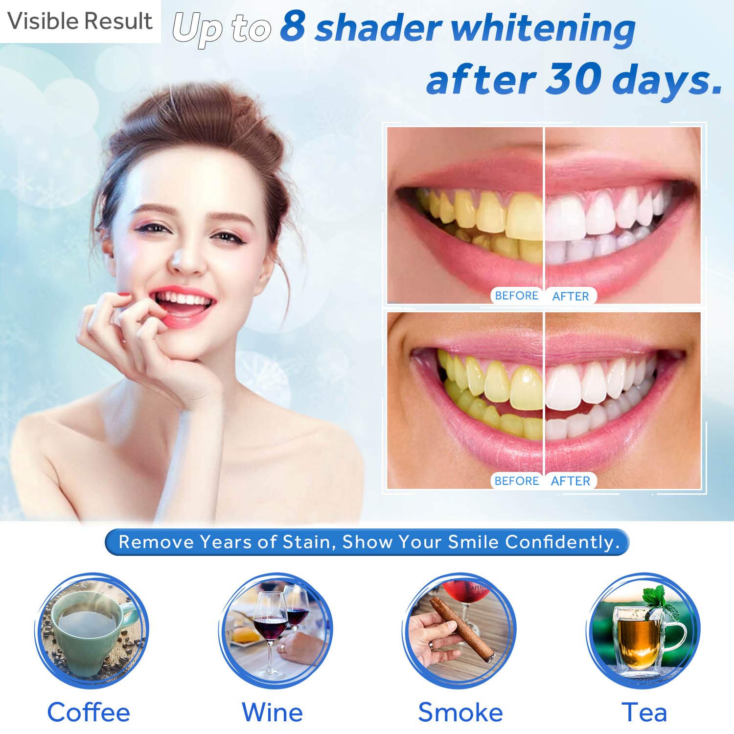 Tanden Whitening Gel Refill Sp - Teeth Whitening With Trays recensie en prijs