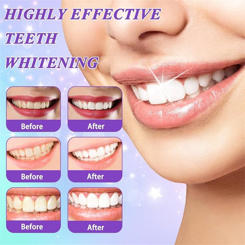 9D Paarse Tandenbleek Tandpast - Teeth Whitening Treatment recensie en prijs
