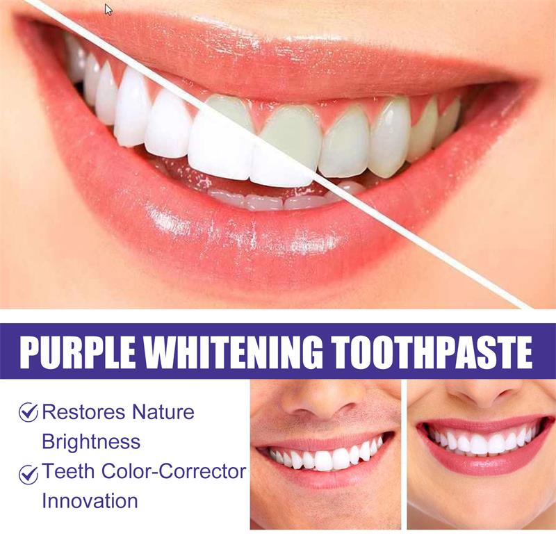 9D Paarse Tandenbleek Tandpast - Teeth Whitening Treatment recensie en prijs