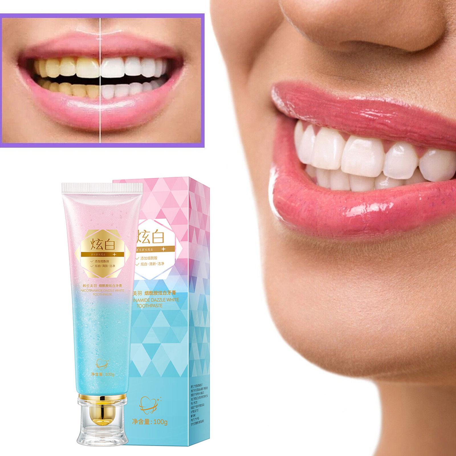 Niacinamide Whitening Tandpast - Teeth Whitening Treatment recensie en prijs