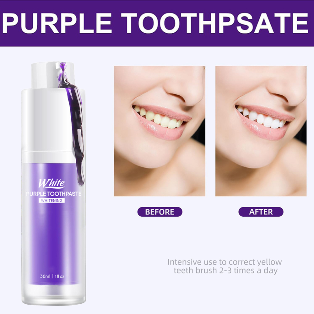 Paarse Whitening Tandpasta 30m - Teeth Whitening Treatment recensie en prijs