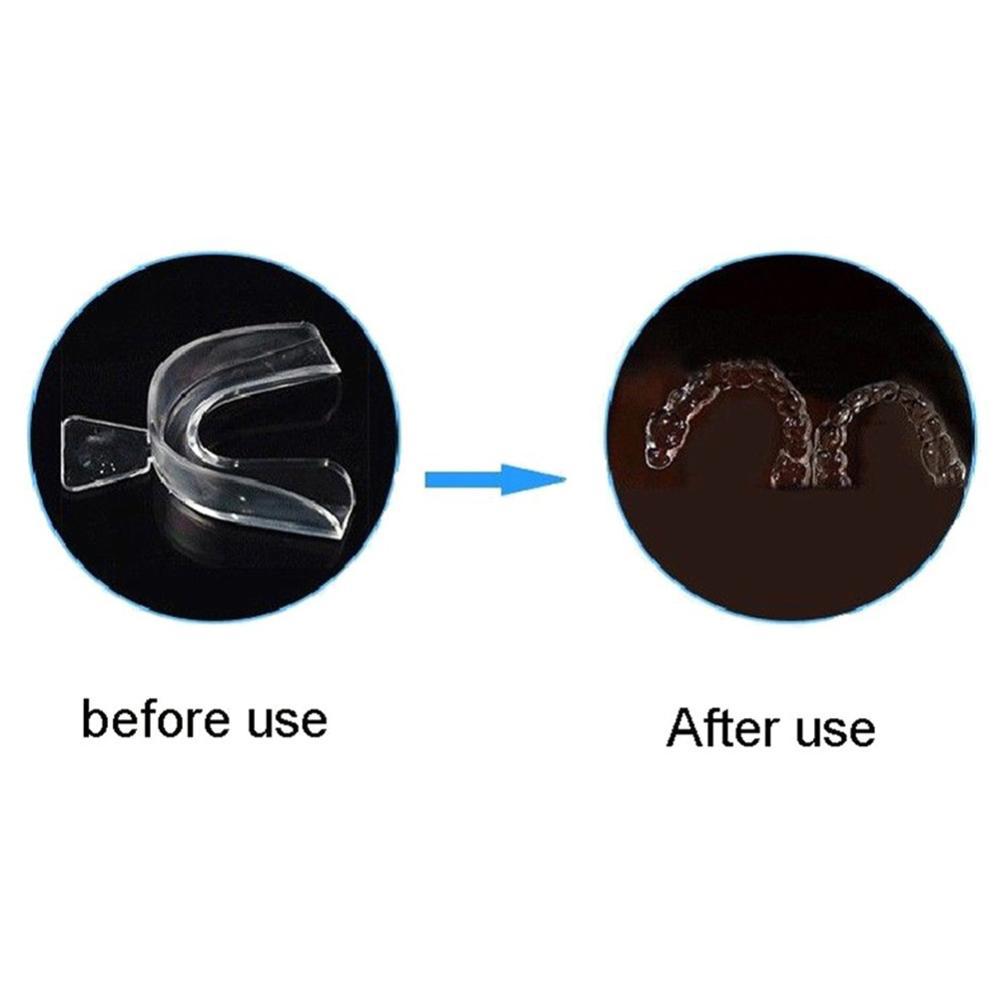 Siliconen mondbeschermer ortho - Teeth Whitening With Trays recensie en prijs