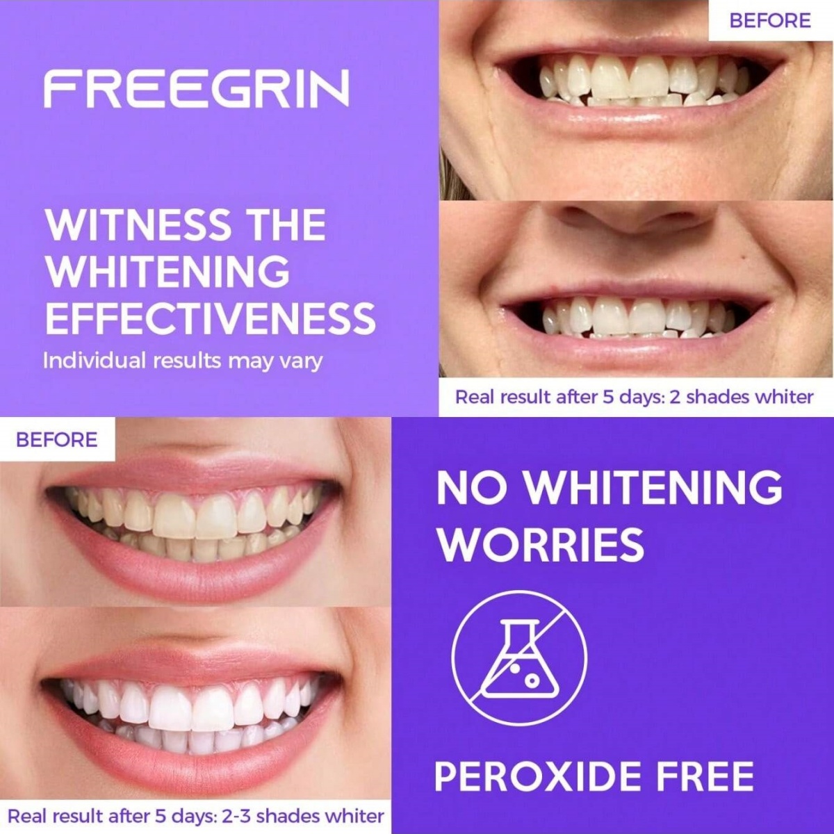 Deluxe Tanden Whitening Sticke - Teeth Whitening Results recensie en prijs
