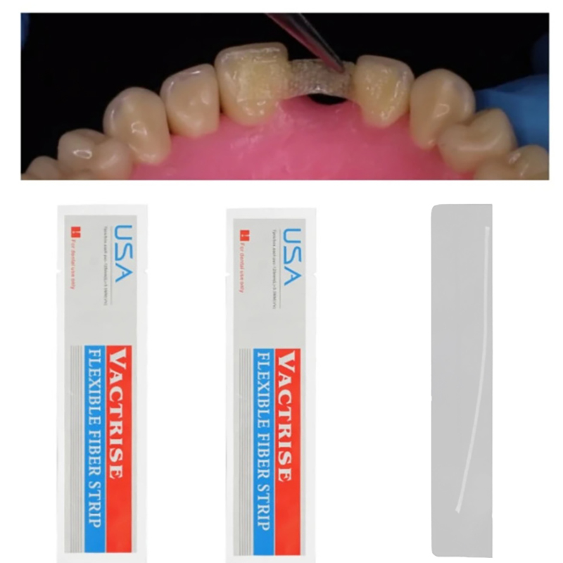 1 Stuks Tandheelkundige Flexib - Teeth Whitening Zoom recensie en prijs