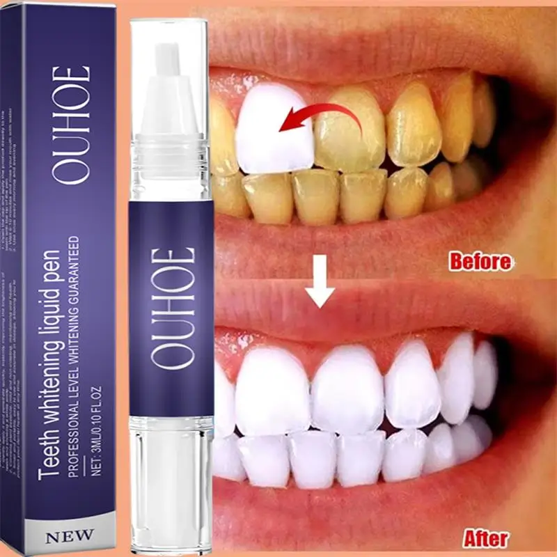 Snelle Tanden Whitening Tandpa - Whitening Pen Bleach recensie en prijs